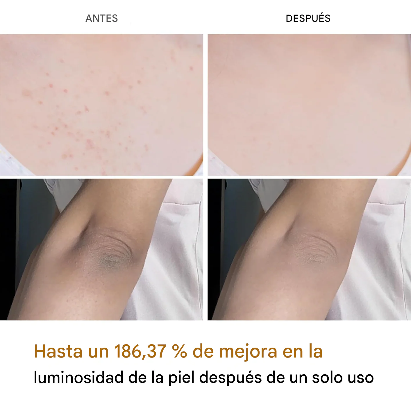 🎁 Compra 1 y Lleva 2  |  Exfoliante Melaxin para Aclarar Partes Oscuras  |  Fórmula con Cúrcuma